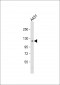 FAK1 Antibody (Y576)